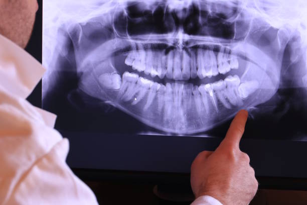 Best Emergency Root Canal Therapy in Charlestown, IN