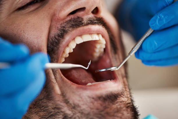Best Emergency Treatment for Oral Infections in Charlestown, IN