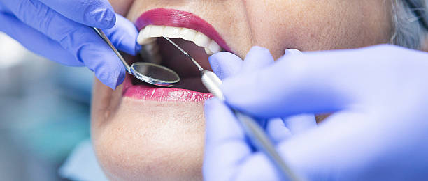 Best Broken or Chipped Tooth Repair in Charlestown, IN